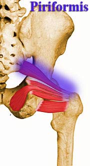 piriformis posture problem